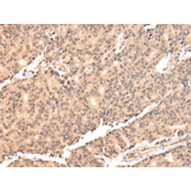 Immunohistochemistry - USP45 Antibody from Signalway Antibody (42822) - Antibodies.com