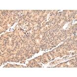 Immunohistochemistry - USP45 Antibody from Signalway Antibody (42822) - Antibodies.com