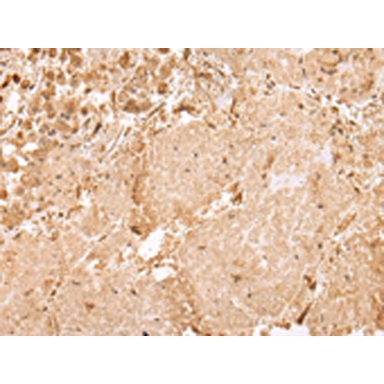 Immunohistochemistry - USP45 Antibody from Signalway Antibody (42822) - Antibodies.com