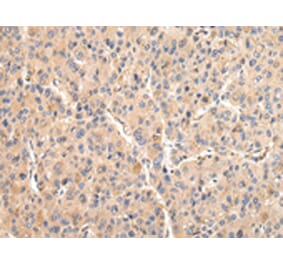 Immunohistochemistry - VCAM1 Antibody from Signalway Antibody (42829) - Antibodies.com