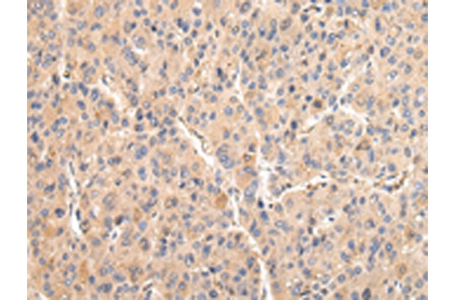 Immunohistochemistry - VCAM1 Antibody from Signalway Antibody (42829) - Antibodies.com