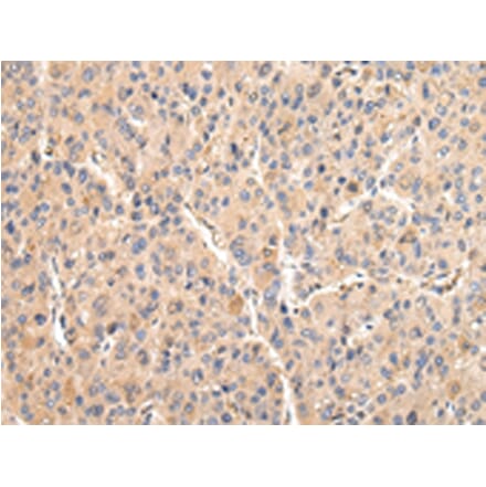 Immunohistochemistry - VCAM1 Antibody from Signalway Antibody (42829) - Antibodies.com