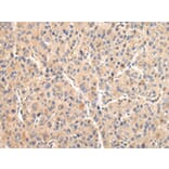 Immunohistochemistry - VCAM1 Antibody from Signalway Antibody (42829) - Antibodies.com