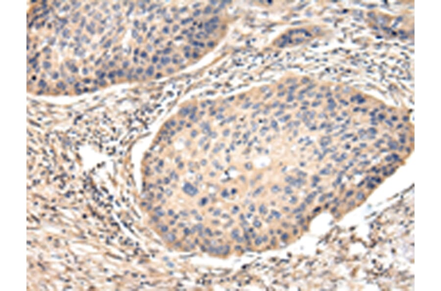 Immunohistochemistry - VCAM1 Antibody from Signalway Antibody (42829) - Antibodies.com