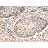 Immunohistochemistry - VCAM1 Antibody from Signalway Antibody (42829) - Antibodies.com
