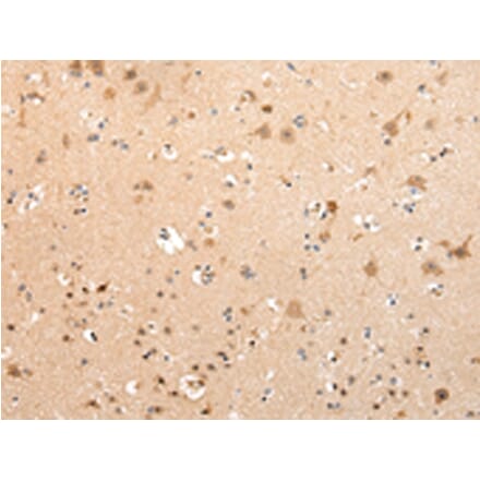 Immunohistochemistry - VPS16 Antibody from Signalway Antibody (42834) - Antibodies.com