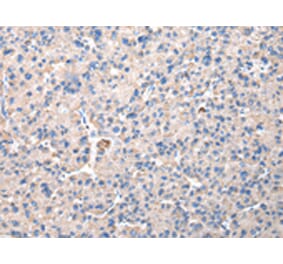 Immunohistochemistry - CHMP3 Antibody from Signalway Antibody (42835) - Antibodies.com