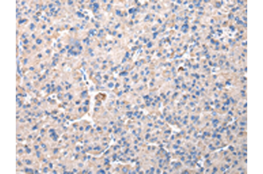 Immunohistochemistry - CHMP3 Antibody from Signalway Antibody (42835) - Antibodies.com