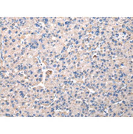 Immunohistochemistry - CHMP3 Antibody from Signalway Antibody (42835) - Antibodies.com