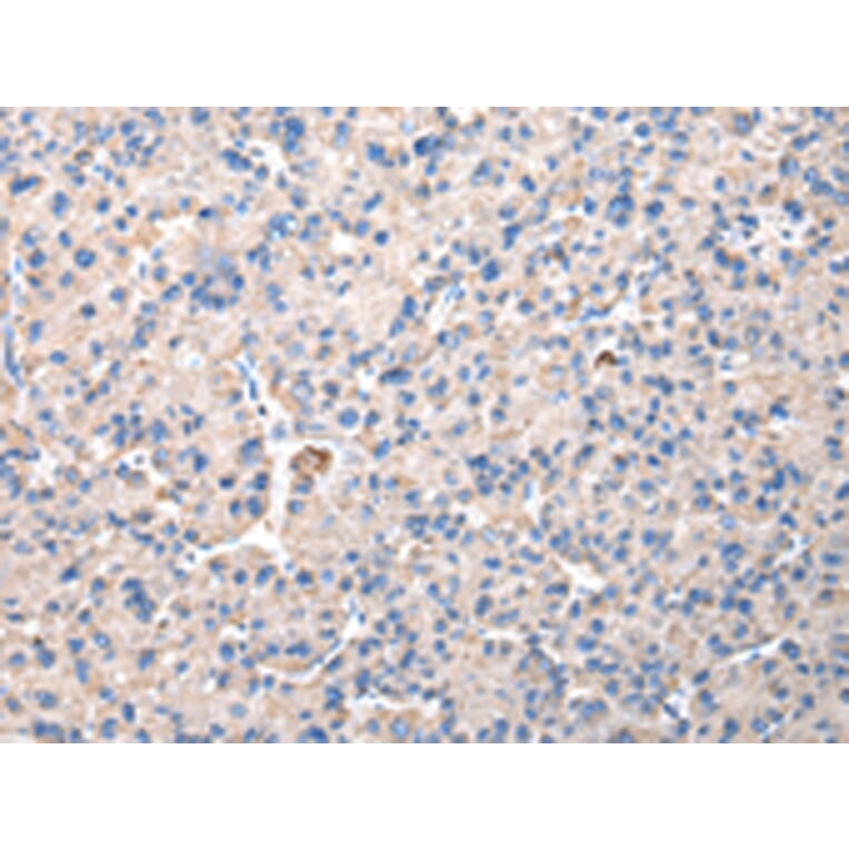 Immunohistochemistry - CHMP3 Antibody from Signalway Antibody (42835) - Antibodies.com