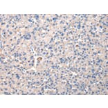 Immunohistochemistry - CHMP3 Antibody from Signalway Antibody (42835) - Antibodies.com