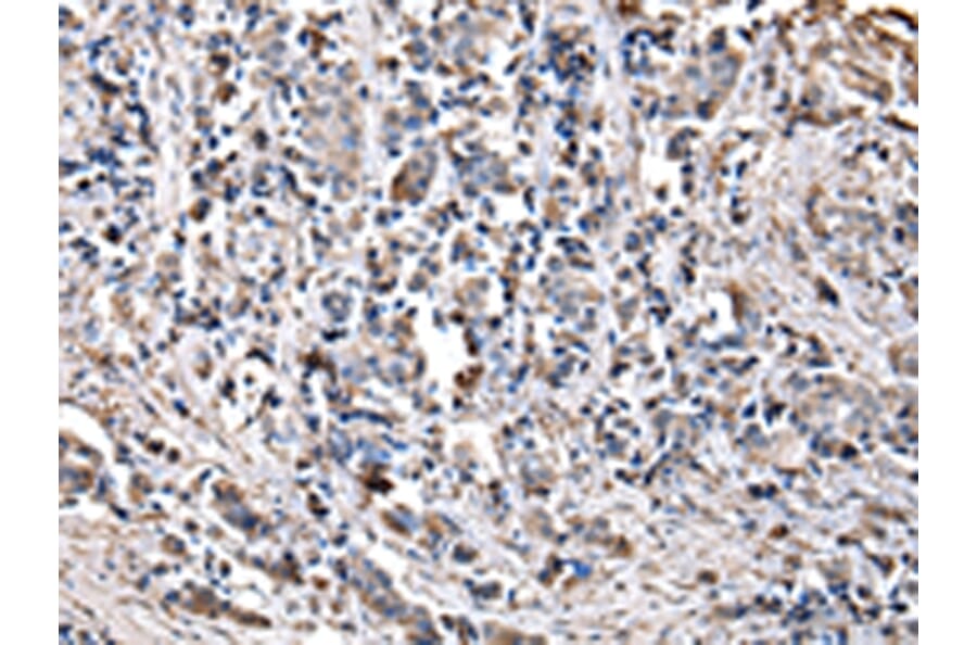 Immunohistochemistry - CHMP3 Antibody from Signalway Antibody (42835) - Antibodies.com
