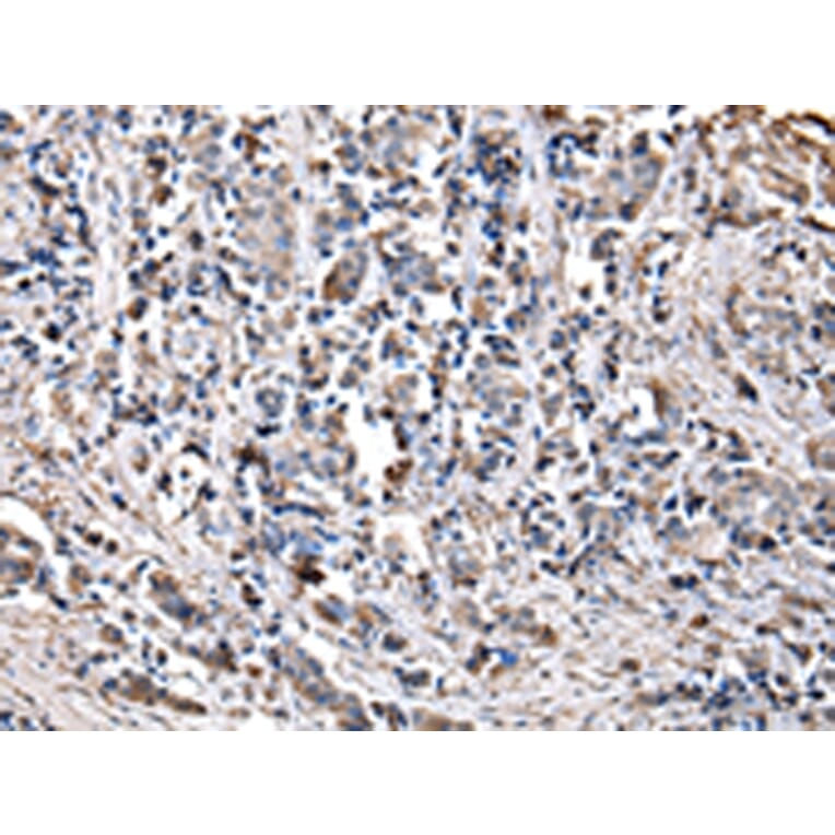 Immunohistochemistry - CHMP3 Antibody from Signalway Antibody (42835) - Antibodies.com
