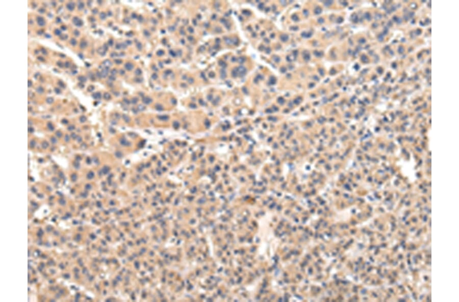 Immunohistochemistry - VPS45 Antibody from Signalway Antibody (42838) - Antibodies.com
