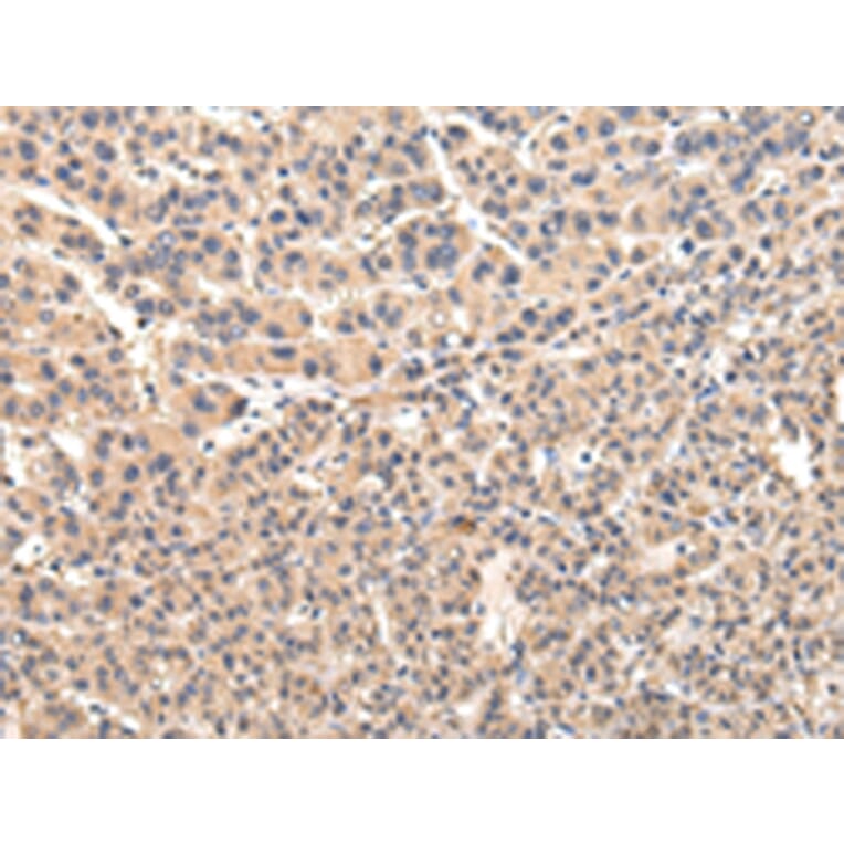 Immunohistochemistry - VPS45 Antibody from Signalway Antibody (42838) - Antibodies.com
