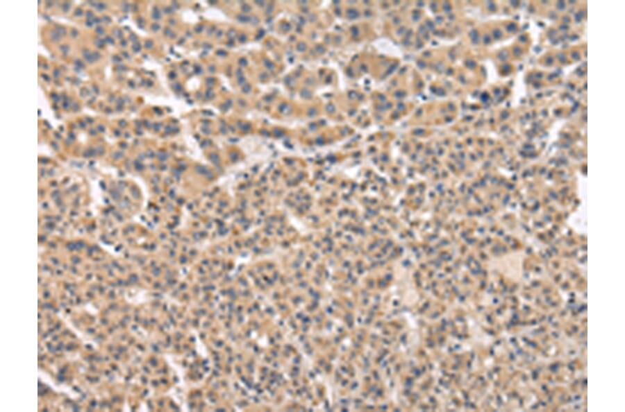 Immunohistochemistry - VPS41 Antibody from Signalway Antibody (42839) - Antibodies.com