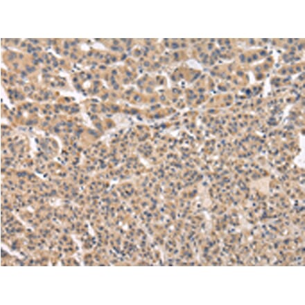 Immunohistochemistry - VPS41 Antibody from Signalway Antibody (42839) - Antibodies.com