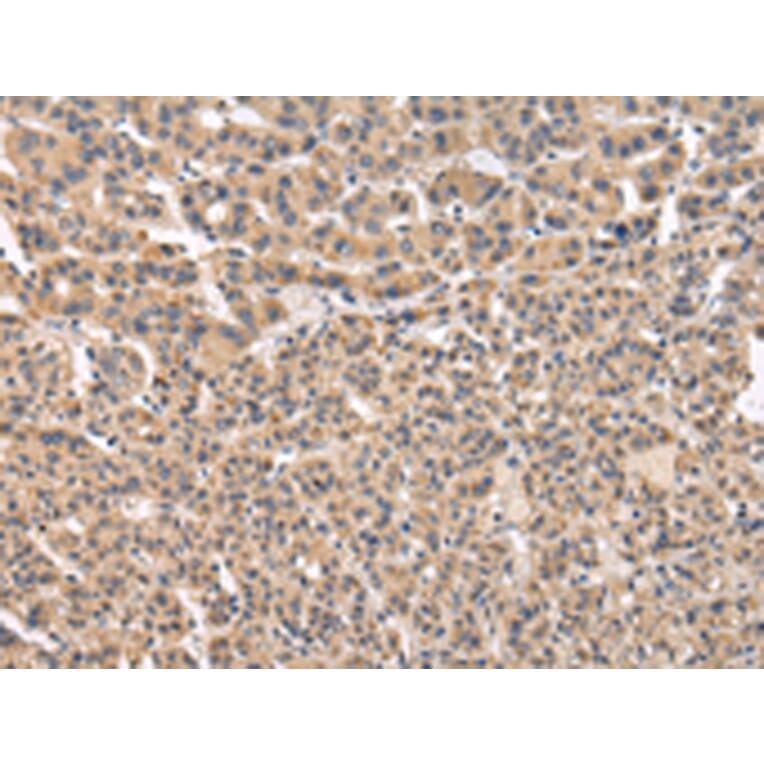 Immunohistochemistry - VPS41 Antibody from Signalway Antibody (42839) - Antibodies.com