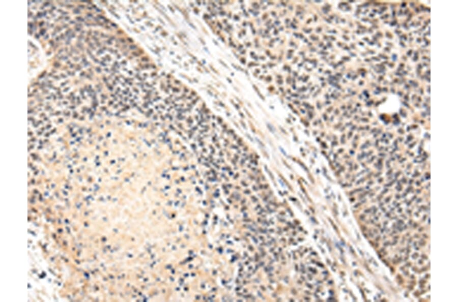 Immunohistochemistry - VPS41 Antibody from Signalway Antibody (42839) - Antibodies.com