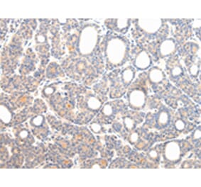 Immunohistochemistry - VPS54 Antibody from Signalway Antibody (42840) - Antibodies.com