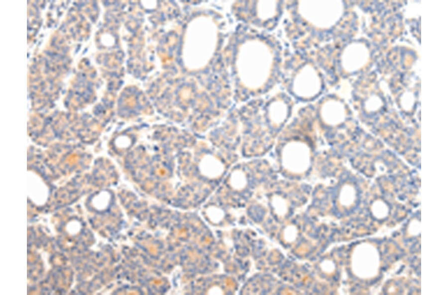 Immunohistochemistry - VPS54 Antibody from Signalway Antibody (42840) - Antibodies.com