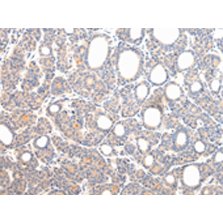 Immunohistochemistry - VPS54 Antibody from Signalway Antibody (42840) - Antibodies.com