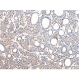 Immunohistochemistry - VPS54 Antibody from Signalway Antibody (42840) - Antibodies.com