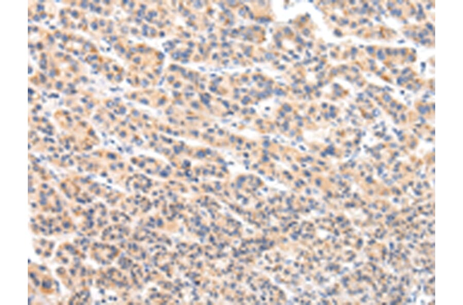 Immunohistochemistry - VPS54 Antibody from Signalway Antibody (42840) - Antibodies.com