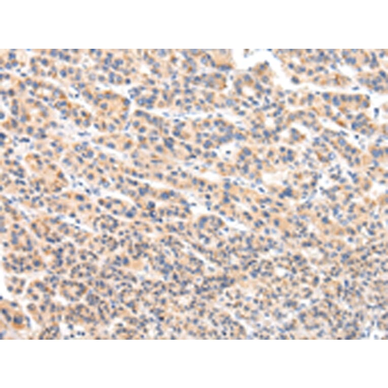 Immunohistochemistry - VPS54 Antibody from Signalway Antibody (42840) - Antibodies.com