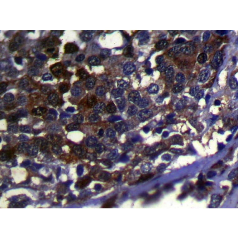 Immunohistochemistry - WDR41 Antibody from Signalway Antibody (42848) - Antibodies.com