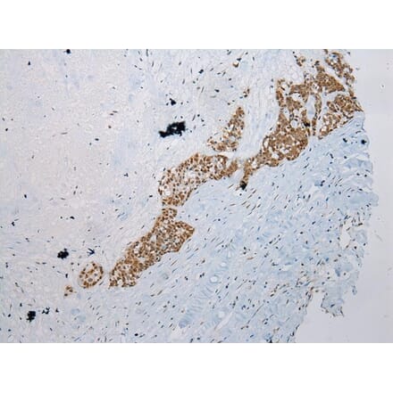 Immunohistochemistry - WDR45 Antibody from Signalway Antibody (42849) - Antibodies.com