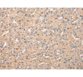 Immunohistochemistry - WDR18 Antibody from Signalway Antibody (42850) - Antibodies.com