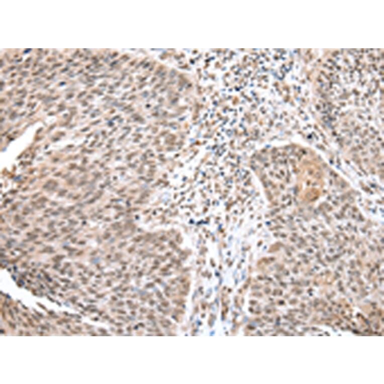 Immunohistochemistry - WDR18 Antibody from Signalway Antibody (42850) - Antibodies.com
