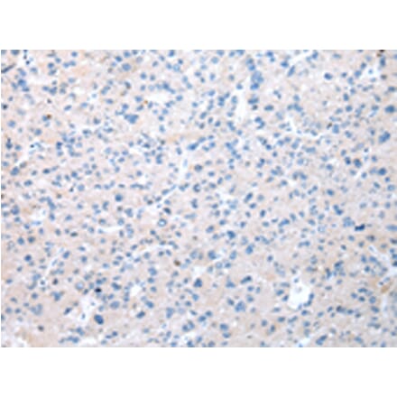 Immunohistochemistry - WDR19 Antibody from Signalway Antibody (42851) - Antibodies.com