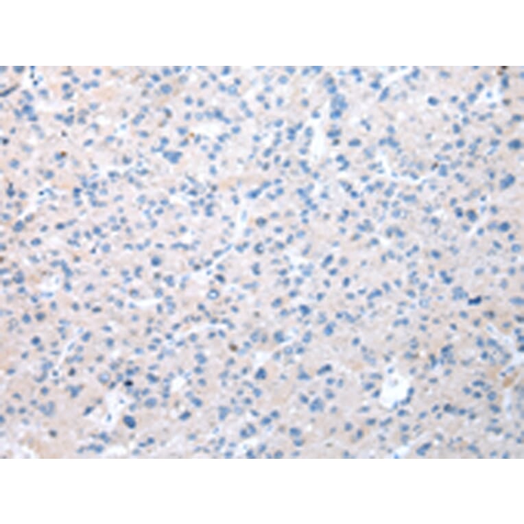 Immunohistochemistry - WDR19 Antibody from Signalway Antibody (42851) - Antibodies.com