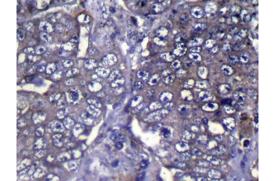 Immunohistochemistry - WDR61 Antibody from Signalway Antibody (42853) - Antibodies.com