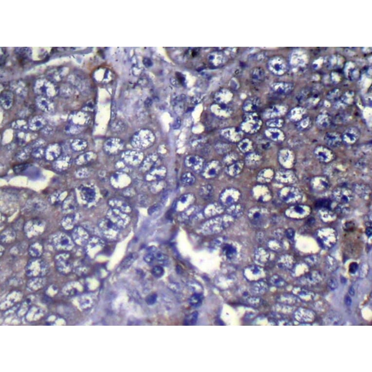 Immunohistochemistry - WDR61 Antibody from Signalway Antibody (42853) - Antibodies.com