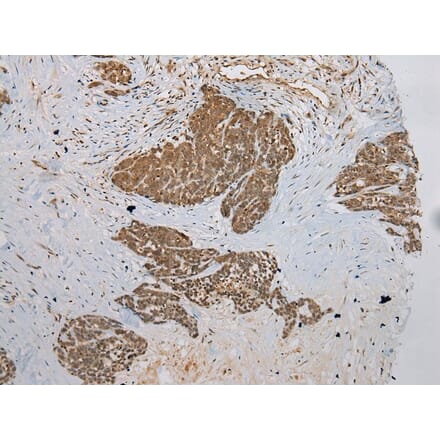 Immunohistochemistry - DCAF7 Antibody from Signalway Antibody (42854) - Antibodies.com