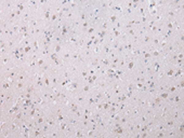 Immunohistochemical analysis of paraffin-embedded Human brain tissue using #42859 at dilution 1/20,