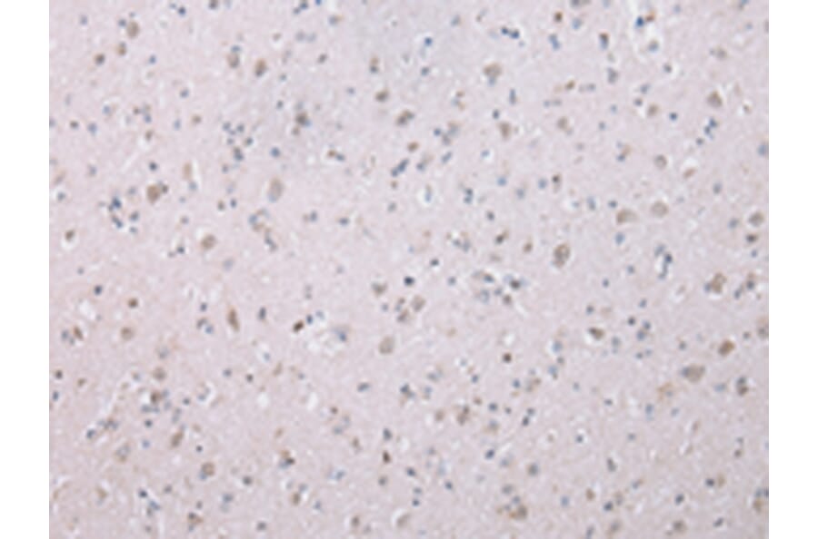 Immunohistochemistry - WISP3 Antibody from Signalway Antibody (42859) - Antibodies.com