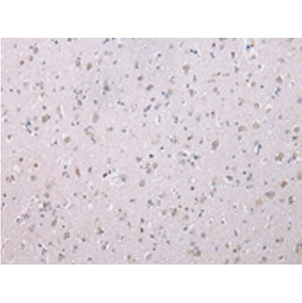Immunohistochemistry - WISP3 Antibody from Signalway Antibody (42859) - Antibodies.com