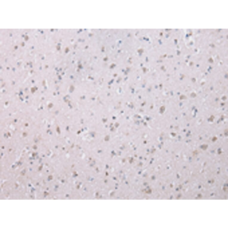 Immunohistochemistry - WISP3 Antibody from Signalway Antibody (42859) - Antibodies.com