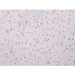 Immunohistochemistry - WISP3 Antibody from Signalway Antibody (42859) - Antibodies.com