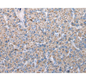 Immunohistochemistry - FKBPL Antibody from Signalway Antibody (42860) - Antibodies.com