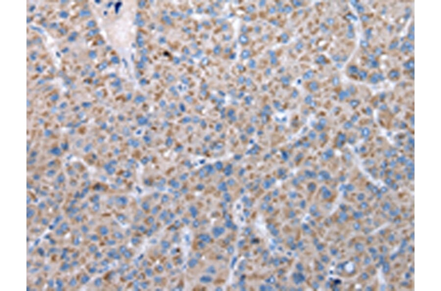 Immunohistochemistry - FKBPL Antibody from Signalway Antibody (42860) - Antibodies.com