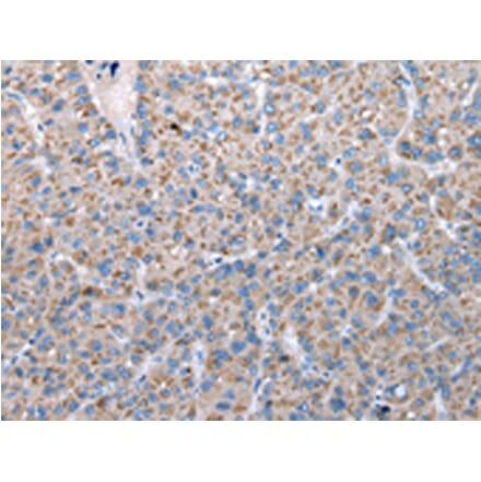 Immunohistochemistry - FKBPL Antibody from Signalway Antibody (42860) - Antibodies.com