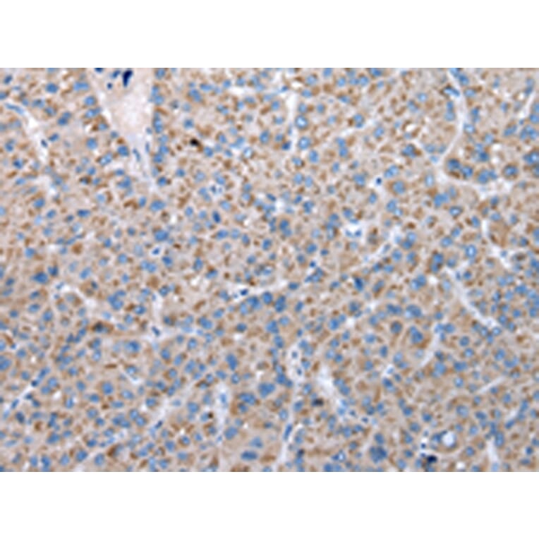 Immunohistochemistry - FKBPL Antibody from Signalway Antibody (42860) - Antibodies.com