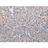 Immunohistochemistry - FKBPL Antibody from Signalway Antibody (42860) - Antibodies.com