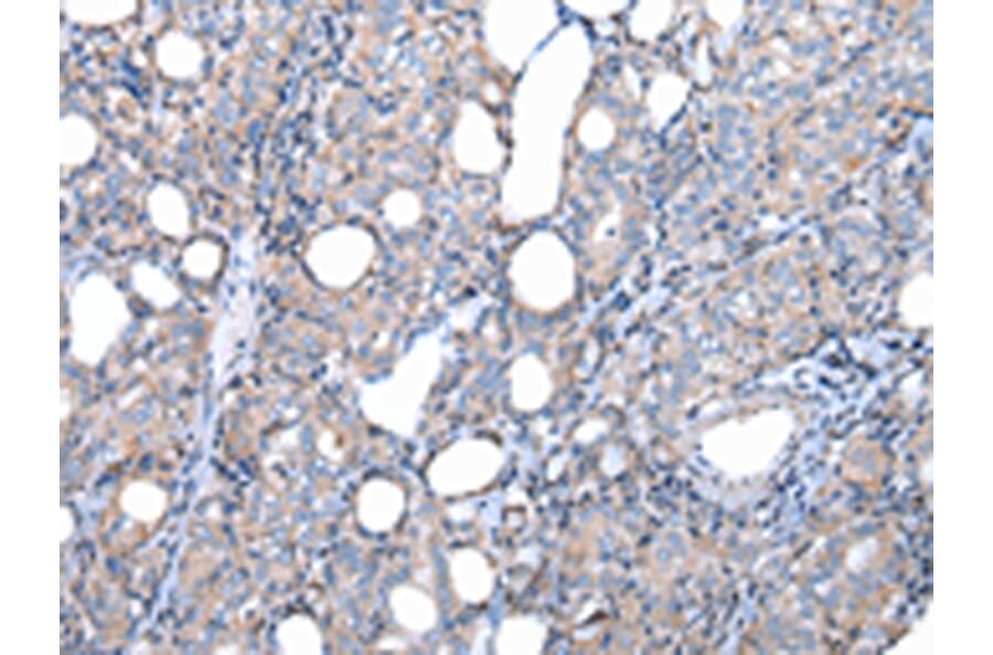 Immunohistochemistry - FKBPL Antibody from Signalway Antibody (42860) - Antibodies.com