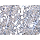 Immunohistochemistry - FKBPL Antibody from Signalway Antibody (42860) - Antibodies.com